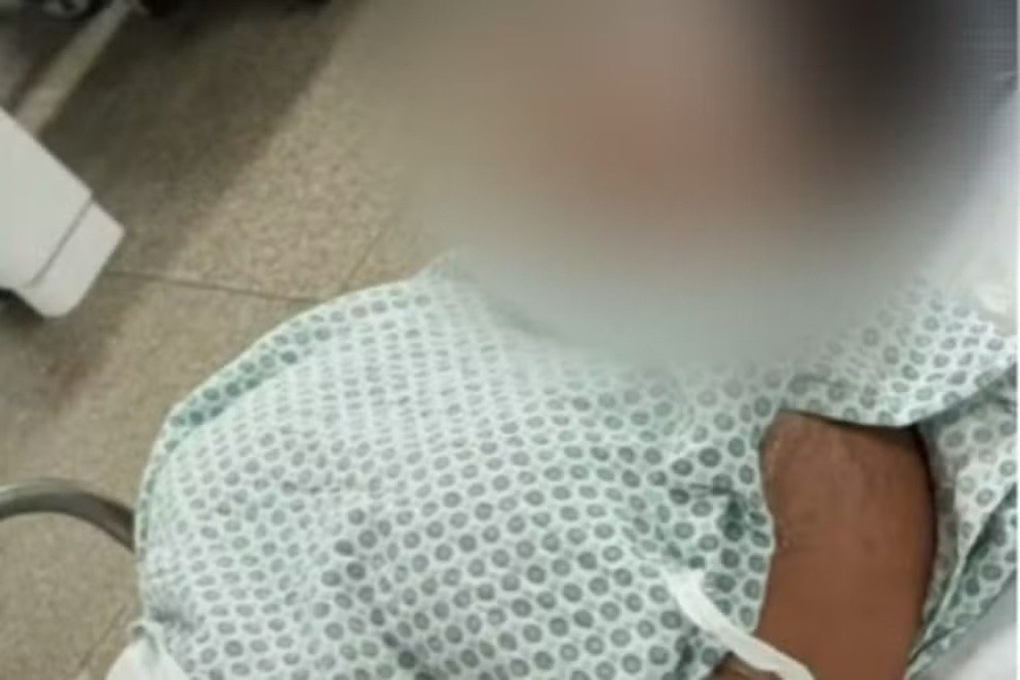 Ataque com ácido deixa mulher ferida em Salvador; suspeita é presa em flagrante - 