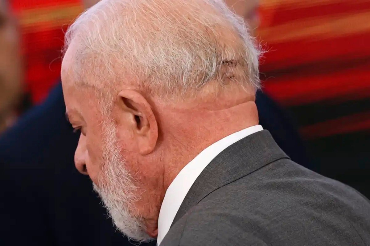 Após passar por cirurgia, Lula deve retomar atividades na próxima semana - 