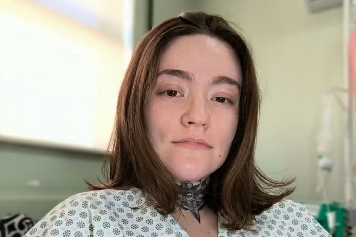 Jovem é diagnosticada com a ‘pior dor do mundo’; Descubra o que é a espondilite anquilosante - 