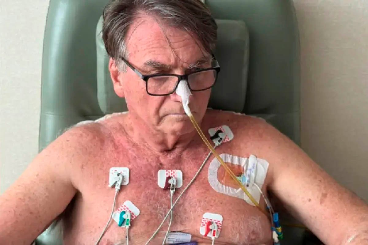 Bolsonaro passa por novo procedimento para tratar crises de soluço em hospital de Brasília - 