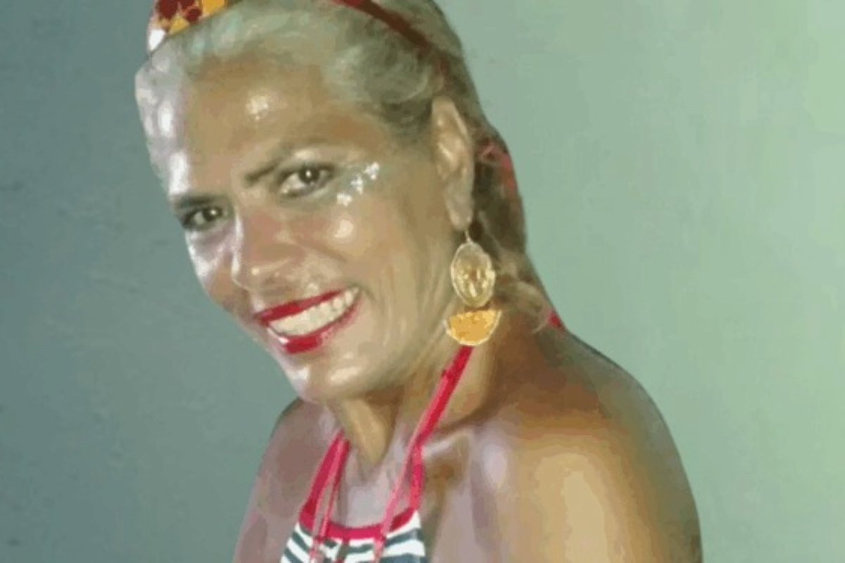 Ex-chacrete, Lia Hollywood morre após complicações de ataque de pitbull no Rio de Janeiro - 